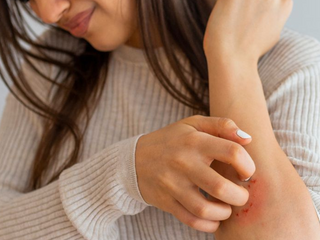 Is My Psoriasis Permanent? Understanding and Managing the Condition