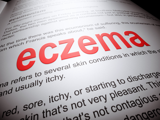 Understanding Eczema: Myths, Causes, and Natural Remedies for Long-Term Eczema Relief