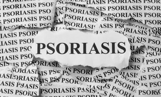 psoriasis symptoms