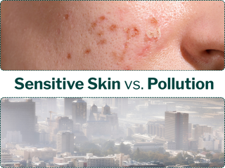 Woman with sensitive skin standing in a polluted city wearing sunscreen, showing skincare protection from urban pollution.