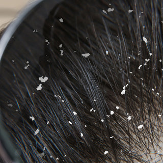 Oleum Cottage Dandruff care collection for flaky scalp, itching, excess oil, and long-lasting scalp barrier support.