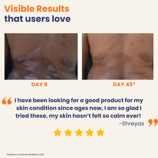 Before and after comparison of skin condition with visible results and customer feedback on a white background.