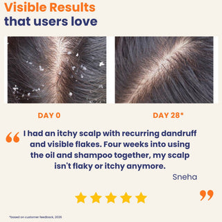 Before and after comparison of scalp with dandruff, showing visible results over 28 days, with customer feedback.