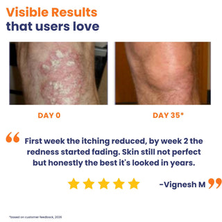 Before and after comparison of skin condition with visible results text and customer feedback.