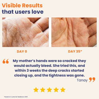 Before and after comparison of cracked skin on hands with a customer testimonial and five-star rating.
