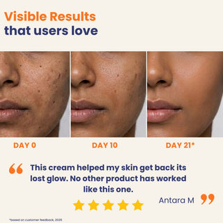 Barrier Repair Face Moisturizer with 2% Ceramide Complex