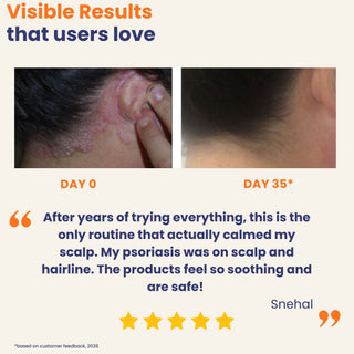 Before and after comparison of scalp condition with customer feedback and rating.
