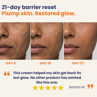 Oleum Cottage Barrier Repair Cream 21-day skin barrier reset results showing improved hydration, stronger skin barrier function, and a healthy radiant glow for all skin types.