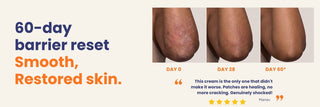 Ultra Healing Cream before and after results showing smoother, restored skin after 60 days. Ultra Healing cream helps reduce cracking, dryness, eczema flare-ups, and damaged skin with consistent use.