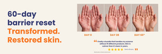 60-day skin barrier repair transformation showing reduced redness, itching, and visible improvement in psoriasis and eczema flareups from day 0 to day 60 with Oleum Cottage's Small Patch Bundle