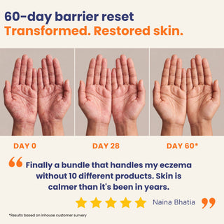 60-day skin barrier repair transformation showing reduced redness, itching, and visible improvement in psoriasis and eczema flareups from day 0 to day 60 with Oleum Cottage's Small Patch Bundle