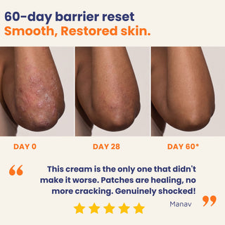 Ultra Healing Cream before and after results showing smoother, restored skin after 60 days. Ultra Healing cream helps reduce cracking, dryness, eczema flare-ups, and damaged skin with consistent use.