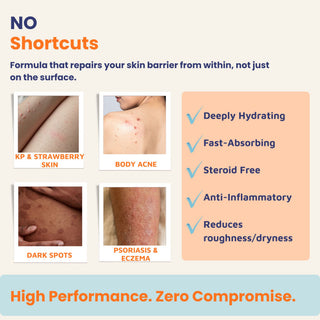 Steroid-free Daily Repair Body Oil for keratosis pilaris, strawberry skin, body acne, eczema, psoriasis, and dark spots. Fast-absorbing barrier repair body oil that deeply hydrates and reduces redness.