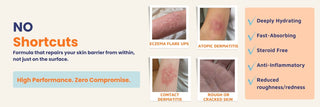 Steroid-free Ultra Healing Cream for eczema, atopic dermatitis, contact dermatitis, rough cracked skin, and dry itchy skin. Fast-absorbing cream that deeply hydrates, reduces redness, and supports long-term skin barrier healing.