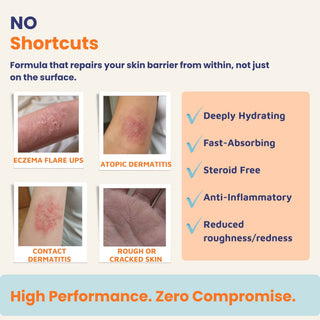 Steroid-free Ultra Healing Cream for eczema, atopic dermatitis, contact dermatitis, rough cracked skin, and dry itchy skin. Fast-absorbing cream that deeply hydrates, reduces redness, and supports long-term skin barrier healing.