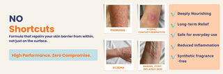 Oleum Cottage Complete Care Bundle for psoriasis, eczema, atopic dermatitis, contact dermatitis, and rashes, providing everyday skin barrier support, reduced inflammation, long-term relief, and synthetic fragrance-free care.