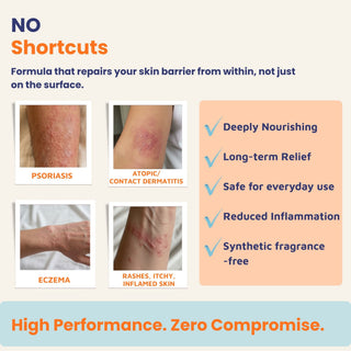 Oleum Cottage Complete Care Bundle for psoriasis, eczema, atopic dermatitis, contact dermatitis, and rashes, providing everyday skin barrier support, reduced inflammation, long-term relief, and synthetic fragrance-free care.