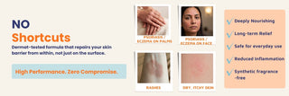  Oleum Cottage Small Patches Bundle supporting psoriasis, eczema, contact dermatitis, and chronic dry skin with skin barrier repair, itch relief, deep nourishment, and fragrance-free ingredients.