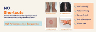  Restorative Oil for skin psoriasis, scalp psoriasis, lichen planus and fungal infection with a dermatologist-tested steroid-free formula that repairs the skin barrier.