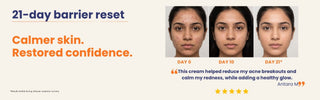 Day 0, Day 10 and Day 21 results showing calmer skin, fewer breakouts and less redness with Barrier Repair Cream