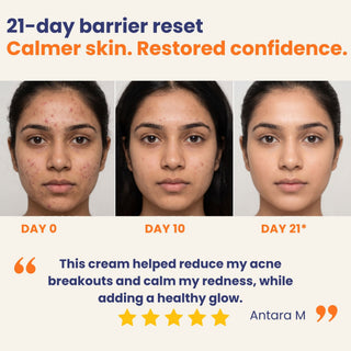 Day 0, Day 10 and Day 21 results showing calmer skin, fewer breakouts and less redness with Barrier Repair Cream