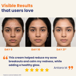 Before and after results of Oleum Cottage Barrier Repair Cream showing healthier, glowing skin after 21 days with improved skin barrier and hydration.