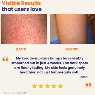 Before and after results using Daily Repair Body Oil showing smoother keratosis pilaris, reduced dark spots, and healthier hydrated skin after 35 days.