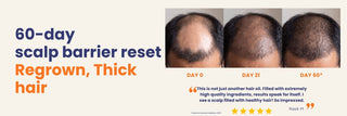 Before and after results using Deeply Conditioning Hair Growth Oil showing thicker, healthier hair and improved scalp condition after 60 days. Hair growth oil for hair fall, alopecia, and thinning hair.