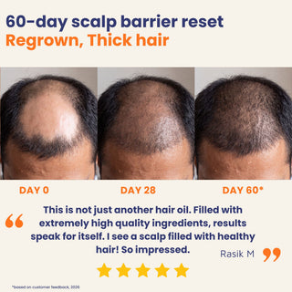Before and after results using Deeply Conditioning Hair Growth Oil showing thicker, healthier hair and improved scalp condition after 60 days. Hair growth oil for hair fall, alopecia, and thinning hair.