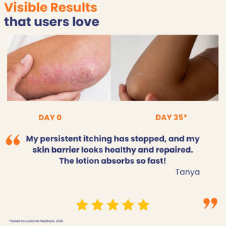 Before and after results using Calming Anti Itch Lotion showing reduced itching, healthier skin barrier, and fast-absorbing hydration after 35 days for dry itchy skin and scalp.