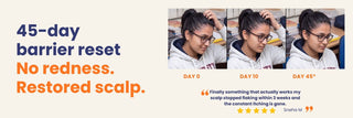 45-day scalp barrier repair results showing reduced redness, scalp flakes and itching with the Scalp Psoriasis & Dermatitis 3 Step Care Bundle.