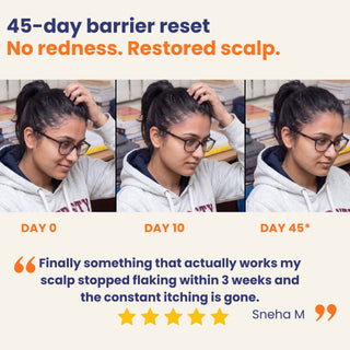 45-day scalp barrier repair results showing reduced redness, scalp flakes and itching with the Scalp Psoriasis & Dermatitis 3 Step Care Bundle.