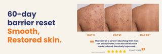 Before and after results using Daily Repair Body Oil showing smoother, hydrated skin with reduced eczema marks and improved skin texture after 60 days.