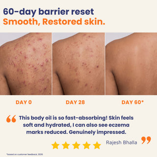 Before and after results using Daily Repair Body Oil showing smoother, hydrated skin with reduced eczema marks and improved skin texture after 60 days.