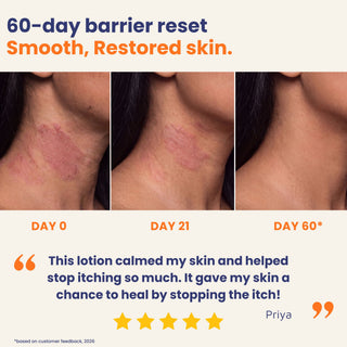  Before and after results using Calming Anti Itch Lotion showing reduced itching and healthier skin after 60 days. Barrier repair lotion for eczema, dermatitis, and chronic dry itchy skin.