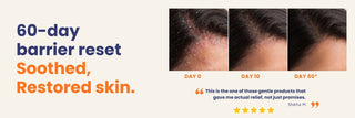 60-day before and after transformation showing reduced psoriasis itching, calmer skin and improved skin barrier with Oleum Cottage Restorative Oil.