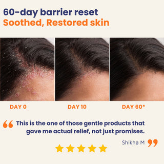 60-day before and after transformation showing reduced psoriasis itching, calmer skin and improved skin barrier with Oleum Cottage Restorative Oil.