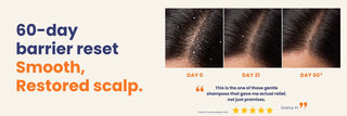 Before and after results using Restorative Shampoo showing a calmer, healthier scalp with reduced dandruff, itching, and flakes after 60 days. Barrier repair shampoo for scalp psoriasis and seborrheic dermatitis.