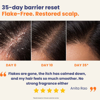 35-day scalp barrier reset showing progressive improvement from day 0 to day 35 with reduced flakes, calmer scalp, itch relief and smoother hair using the Scalp 2 Step Bundle.