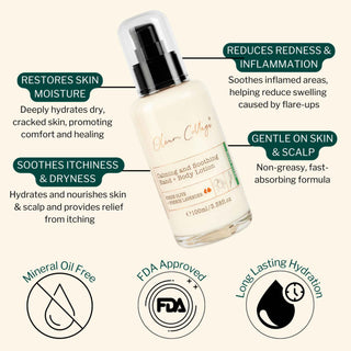 Key benefits of Calming Anti-Itch Lotion include restoring skin moisture, reducing redness, soothing dryness, and gentle hydration for sensitive skin and scalp.