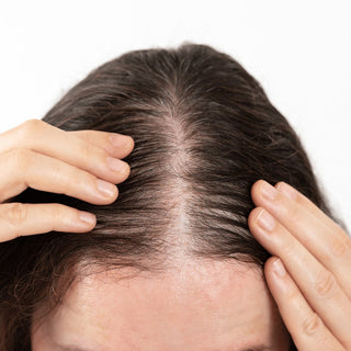 Hair fall and alopecia natural treatment oils by Oleum Cottage for scalp nourishment and stronger growth.