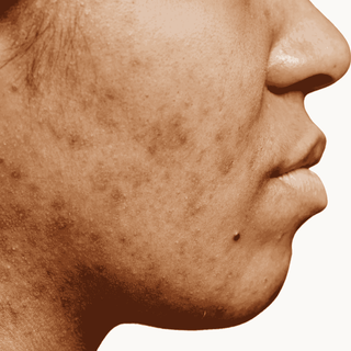 Natural pigmentation and dark spot treatment by Oleum Cottage for clear, even-toned, radiant skin.